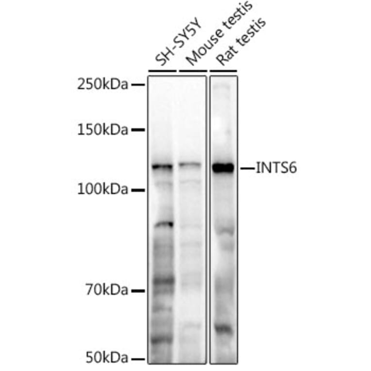 Western Blot - Anti-INTS6 Antibody (A329539) - Antibodies.com
