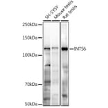 Western Blot - Anti-INTS6 Antibody (A329539) - Antibodies.com