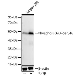 Western Blot - Anti-IRAK4 (Phospho Ser346) Antibody [ARC64221] (A329540) - Antibodies.com