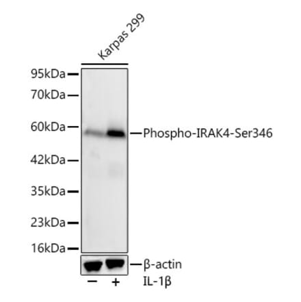 Western Blot - Anti-IRAK4 (Phospho Ser346) Antibody [ARC64221] (A329540) - Antibodies.com