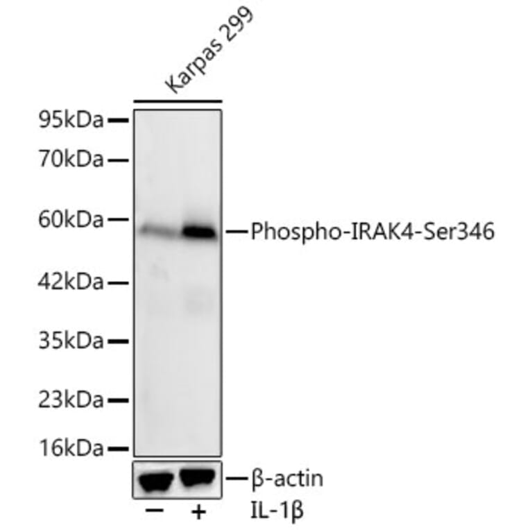 Western Blot - Anti-IRAK4 (Phospho Ser346) Antibody [ARC64221] (A329540) - Antibodies.com