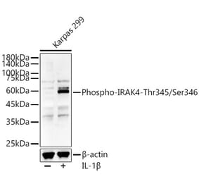 Western Blot - Anti-IRAK4 (Phospho T345/S346) Antibody (A329541) - Antibodies.com