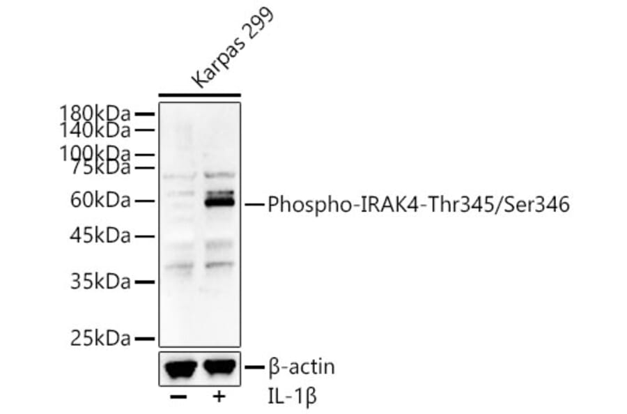 Western Blot - Anti-IRAK4 (Phospho T345/S346) Antibody (A329541) - Antibodies.com