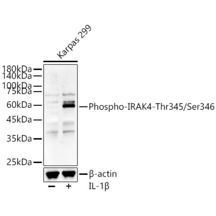 Western Blot - Anti-IRAK4 (Phospho T345/S346) Antibody (A329541) - Antibodies.com