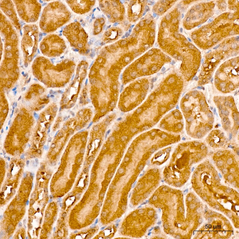 Immunohistochemistry - Anti-IRF3 Antibody (A329542) - Antibodies.com