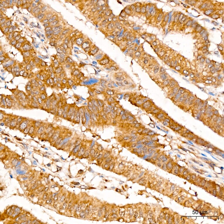 Immunohistochemistry - Anti-IRF3 Antibody (A329542) - Antibodies.com