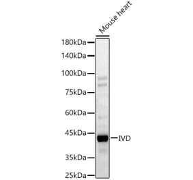 Western Blot - Anti-IVD Antibody (A329543) - Antibodies.com