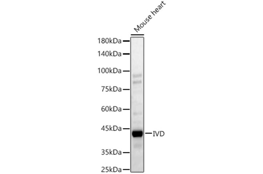 Western Blot - Anti-IVD Antibody (A329543) - Antibodies.com
