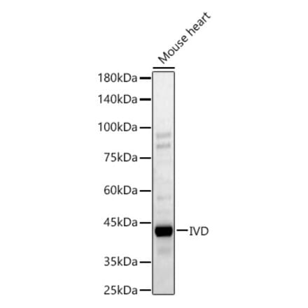 Western Blot - Anti-IVD Antibody (A329543) - Antibodies.com