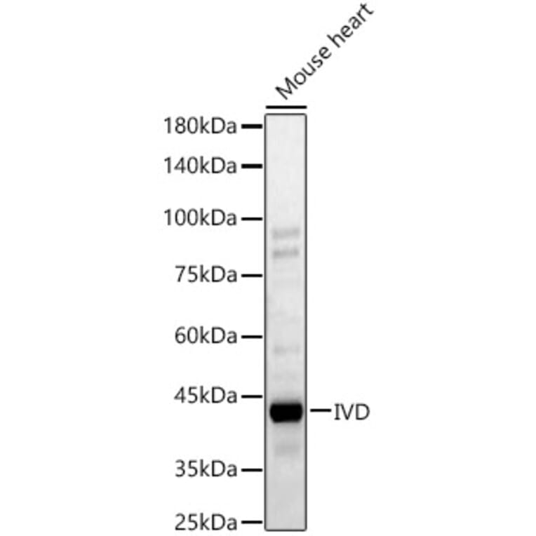 Western Blot - Anti-IVD Antibody (A329543) - Antibodies.com