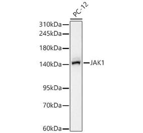 Western Blot - Anti-JAK1 Antibody [ARC65615] (A329544) - Antibodies.com