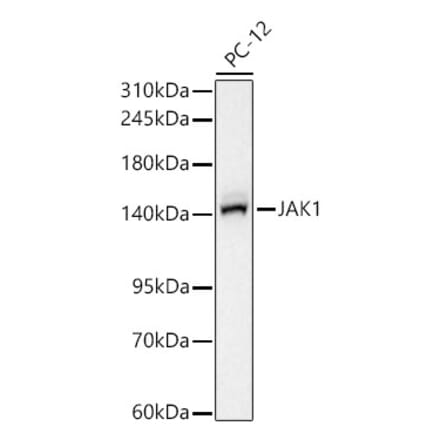 Western Blot - Anti-JAK1 Antibody [ARC65615] (A329544) - Antibodies.com