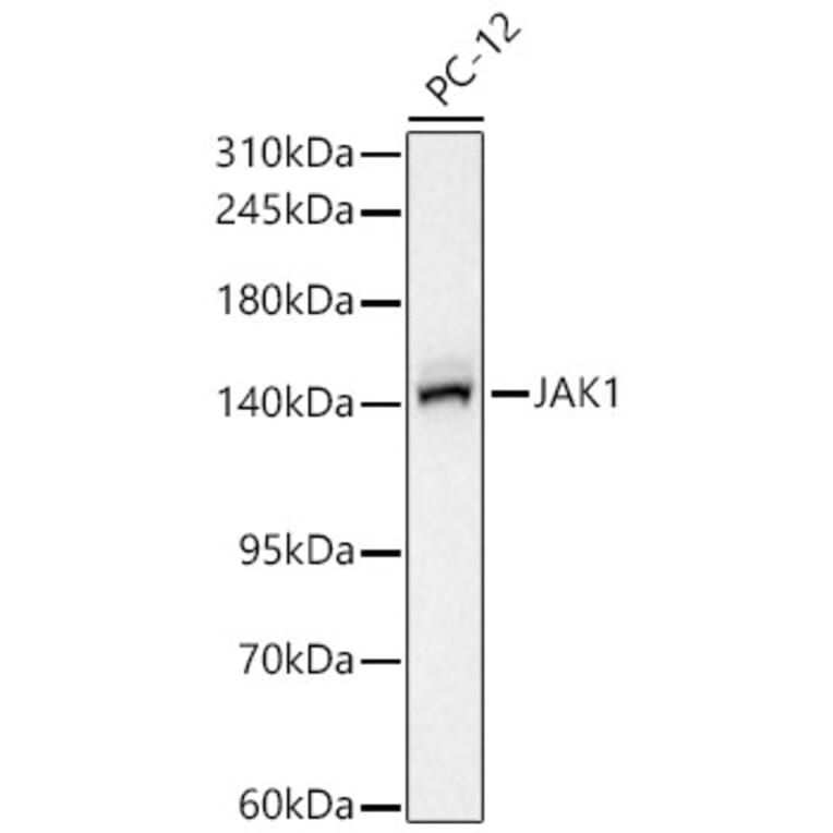 Western Blot - Anti-JAK1 Antibody [ARC65615] (A329544) - Antibodies.com
