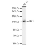 Western Blot - Anti-JAK1 Antibody [ARC65615] (A329544) - Antibodies.com