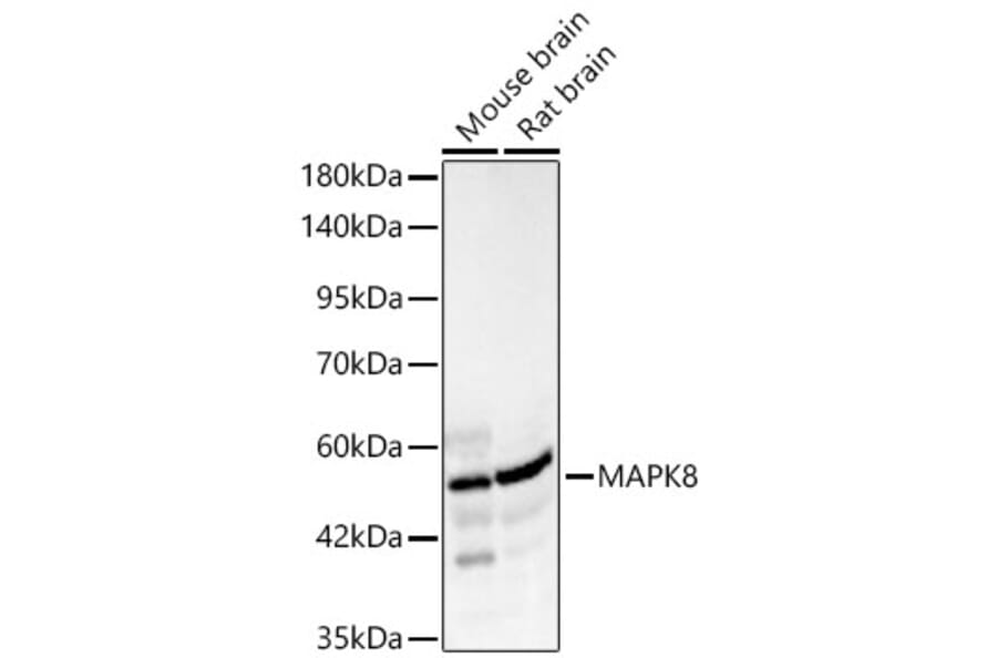Western Blot - Anti-JNK1 Antibody (A329546) - Antibodies.com