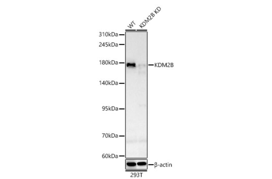 Western Blot - Anti-KDM2B Antibody (A329548) - Antibodies.com