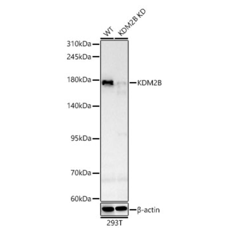 Western Blot - Anti-KDM2B Antibody (A329548) - Antibodies.com