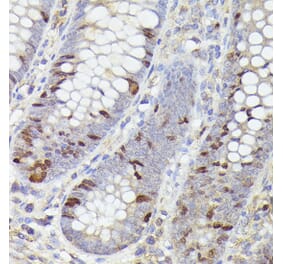 Immunohistochemistry - Anti-Ki67 Antibody [ARC5050-01] (A329549) - Antibodies.com