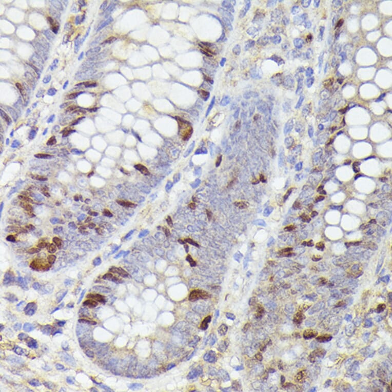 Immunohistochemistry - Anti-Ki67 Antibody [ARC5050-01] (A329549) - Antibodies.com