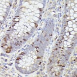 Immunohistochemistry - Anti-Ki67 Antibody [ARC5050-01] (A329549) - Antibodies.com