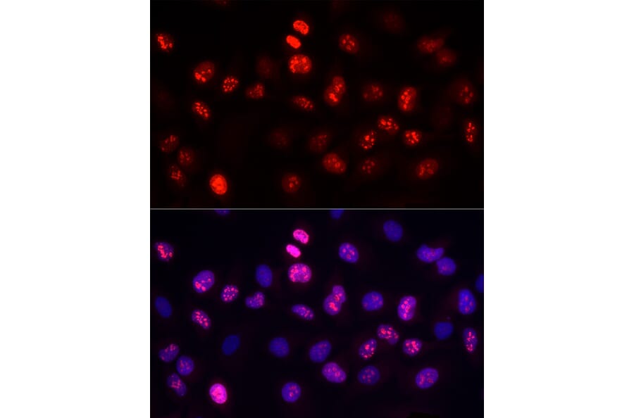 Immunofluorescence - Anti-Ki67 Antibody [ARC5050-01] (A329549) - Antibodies.com