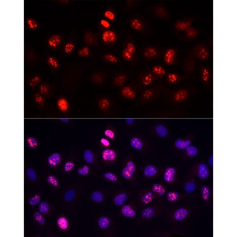 Immunofluorescence - Anti-Ki67 Antibody [ARC5050-01] (A329549) - Antibodies.com