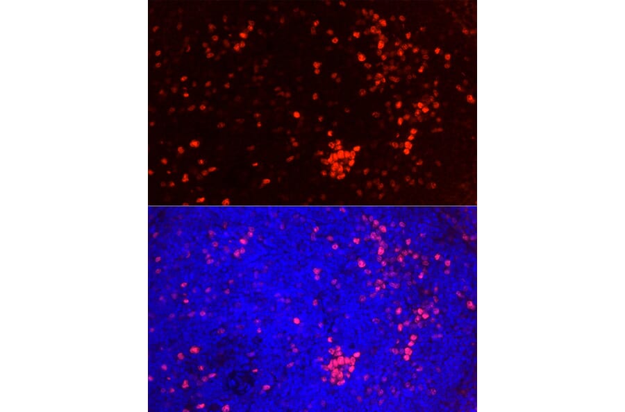 Immunofluorescence - Anti-Ki67 Antibody [ARC5050-01] (A329549) - Antibodies.com