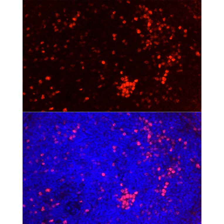 Immunofluorescence - Anti-Ki67 Antibody [ARC5050-01] (A329549) - Antibodies.com