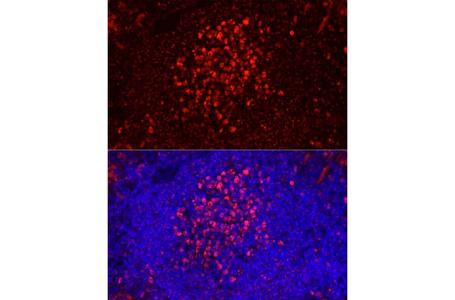 Immunofluorescence - Anti-Ki67 Antibody [ARC5050-01] (A329549) - Antibodies.com