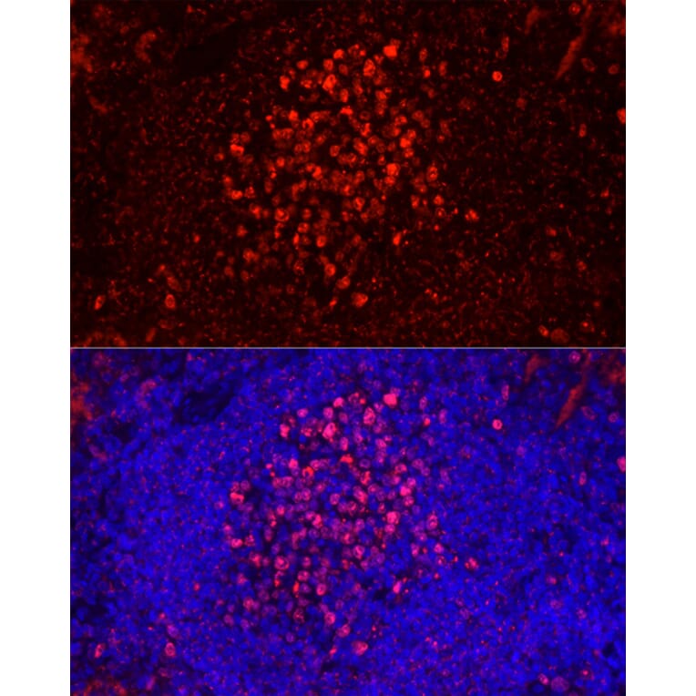 Immunofluorescence - Anti-Ki67 Antibody [ARC5050-01] (A329549) - Antibodies.com