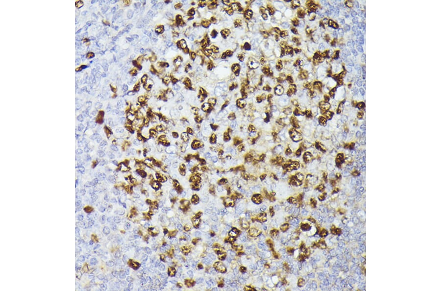 Immunohistochemistry - Anti-Ki67 Antibody [ARC5050-01] (A329549) - Antibodies.com