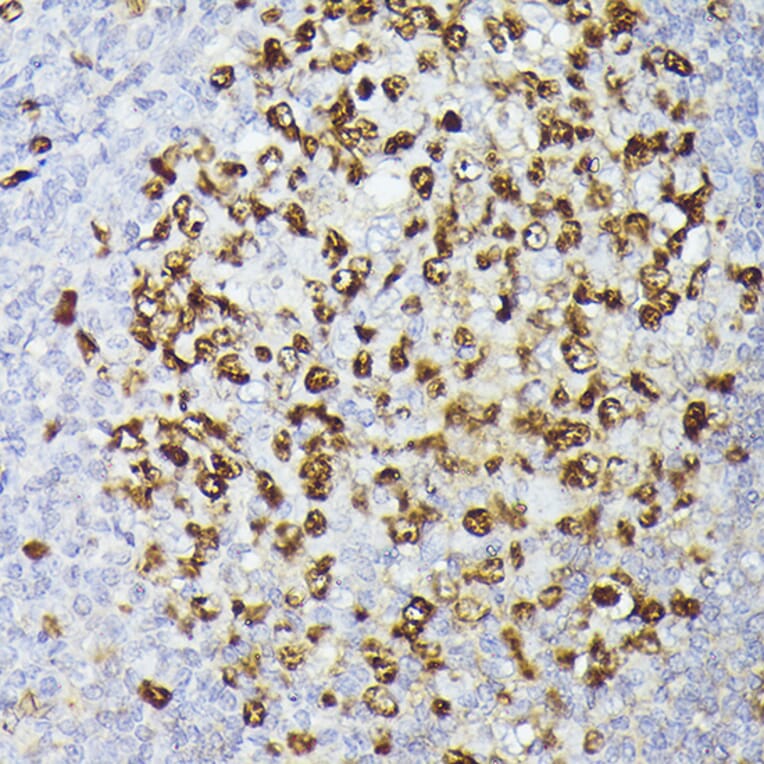 Immunohistochemistry - Anti-Ki67 Antibody [ARC5050-01] (A329549) - Antibodies.com