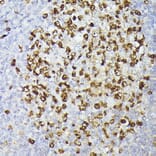 Immunohistochemistry - Anti-Ki67 Antibody [ARC5050-01] (A329549) - Antibodies.com
