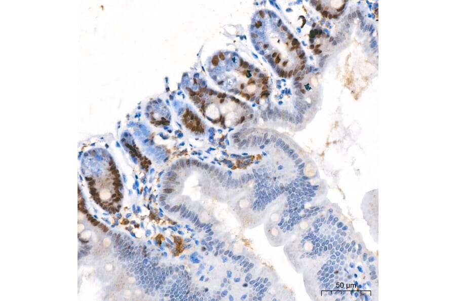 Immunohistochemistry - Anti-Ki67 Antibody [ARC5050-01] (A329549) - Antibodies.com