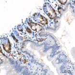 Immunohistochemistry - Anti-Ki67 Antibody [ARC5050-01] (A329549) - Antibodies.com