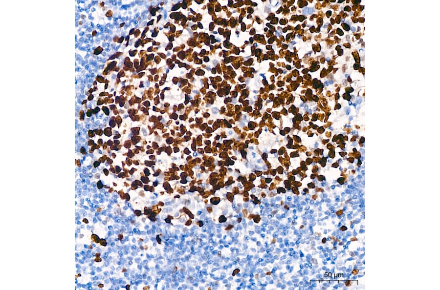 Immunohistochemistry - Anti-Ki67 Antibody [ARC5050-01] (A329549) - Antibodies.com