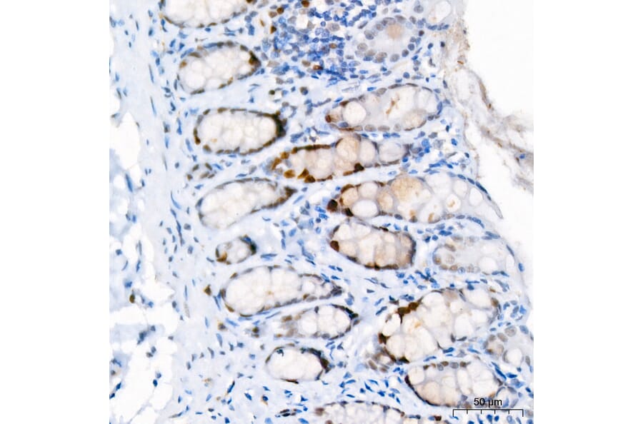 Immunohistochemistry - Anti-Ki67 Antibody [ARC5050-01] (A329549) - Antibodies.com