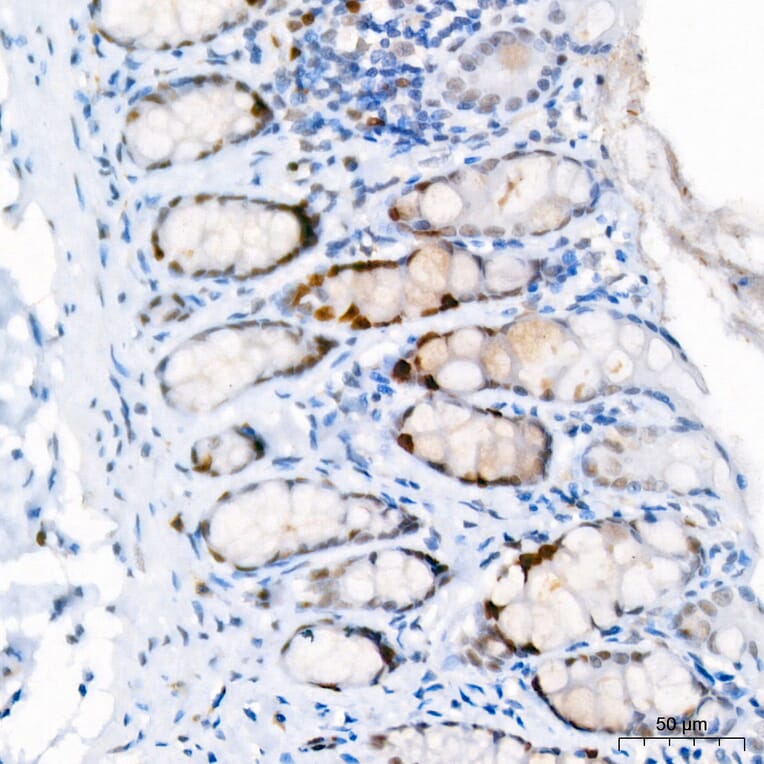 Immunohistochemistry - Anti-Ki67 Antibody [ARC5050-01] (A329549) - Antibodies.com