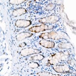 Immunohistochemistry - Anti-Ki67 Antibody [ARC5050-01] (A329549) - Antibodies.com