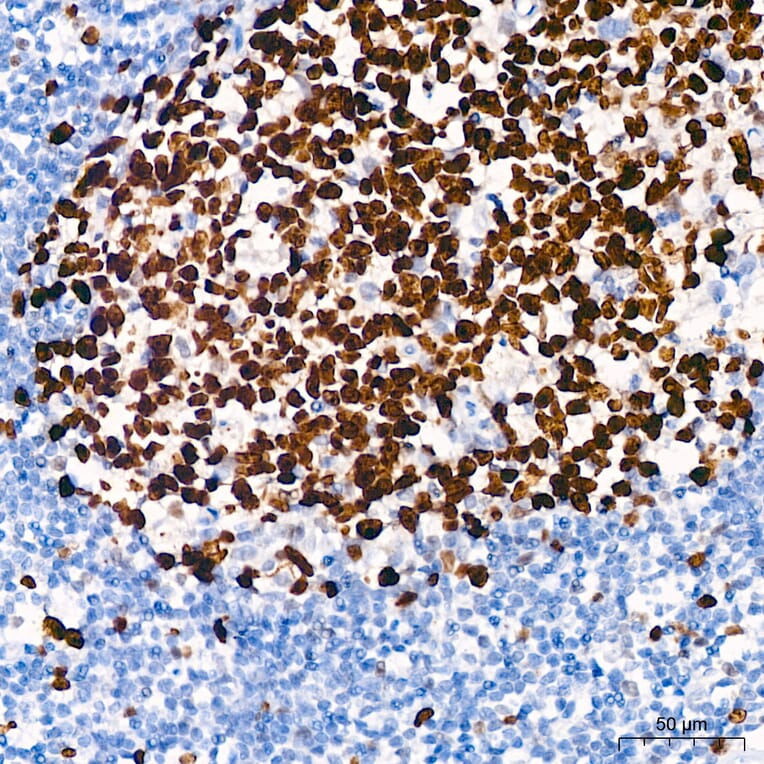 Immunohistochemistry - Anti-Ki67 Antibody [ARC5050-01] (A329549) - Antibodies.com