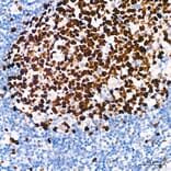 Immunohistochemistry - Anti-Ki67 Antibody [ARC5050-01] (A329549) - Antibodies.com