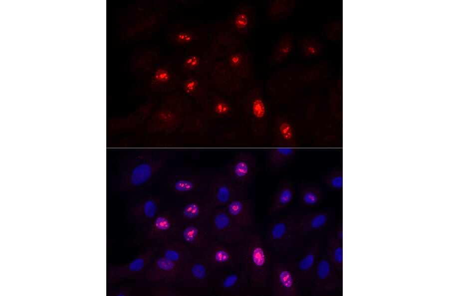 Immunofluorescence - Anti-Ki67 Antibody [ARC5050-01] (A329549) - Antibodies.com