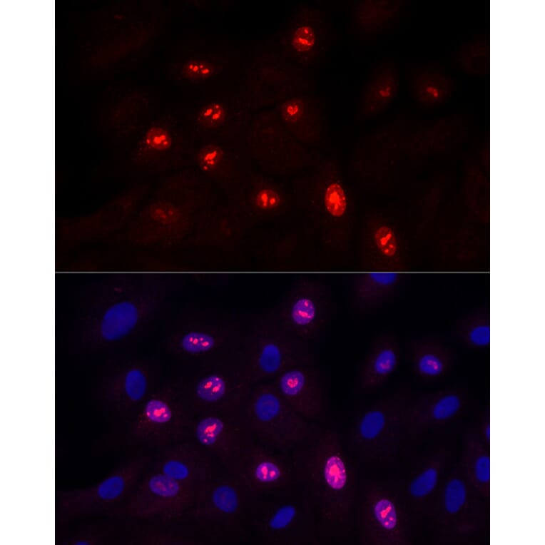 Immunofluorescence - Anti-Ki67 Antibody [ARC5050-01] (A329549) - Antibodies.com