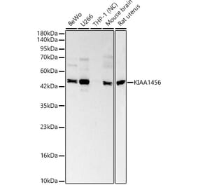 Western Blot - Anti-KIAA1456 Antibody (A329550) - Antibodies.com