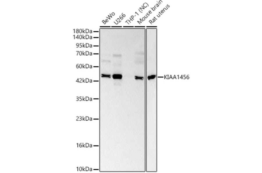 Western Blot - Anti-KIAA1456 Antibody (A329550) - Antibodies.com