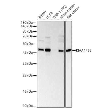 Western Blot - Anti-KIAA1456 Antibody (A329550) - Antibodies.com