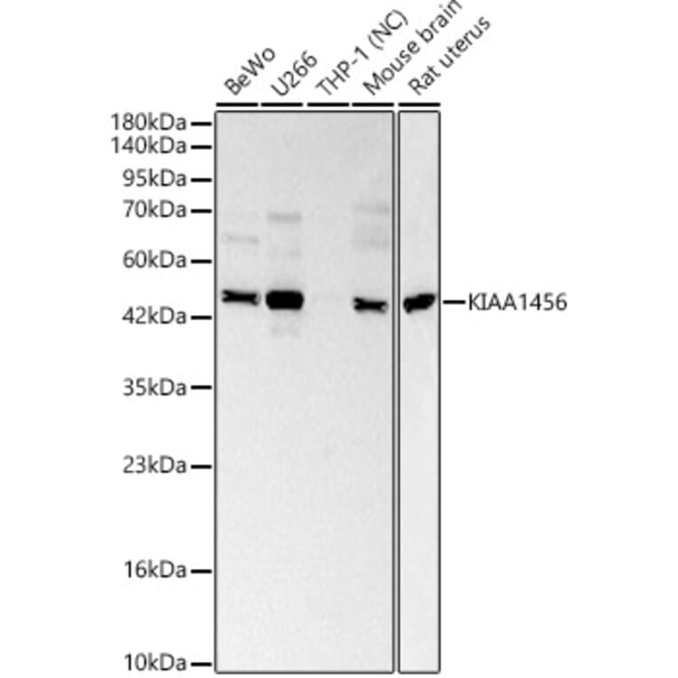 Western Blot - Anti-KIAA1456 Antibody (A329550) - Antibodies.com
