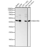 Western Blot - Anti-KIAA1456 Antibody (A329550) - Antibodies.com