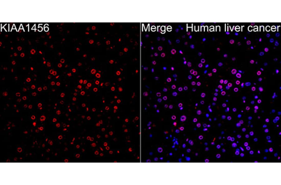Immunofluorescence - Anti-KIAA1456 Antibody (A329550) - Antibodies.com