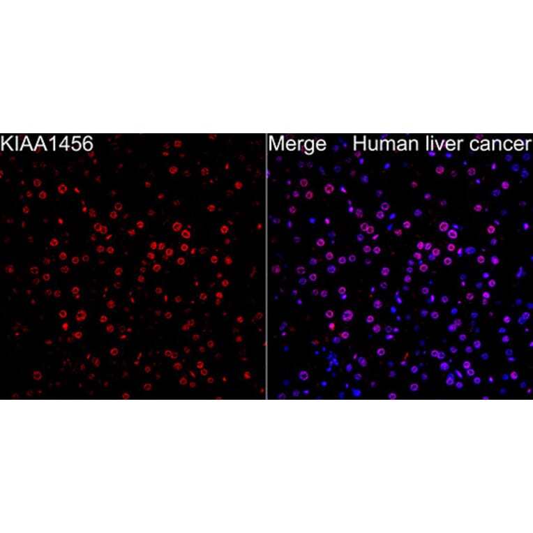 Immunofluorescence - Anti-KIAA1456 Antibody (A329550) - Antibodies.com